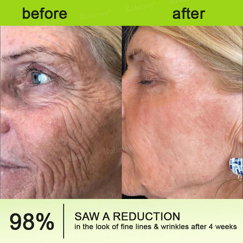 ✨Final 3 Hours: 70%OFF🔥 Botulinum & Vita-A Retinol Shot Wrinkle-Lift Tightening cream✨