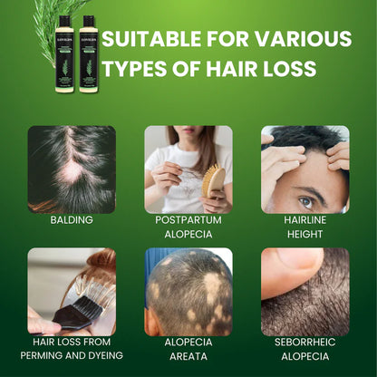 🔥Final 3 Hours: 70%OFF🔥 Rosemary Hydrolyzed Keratin Shampoo