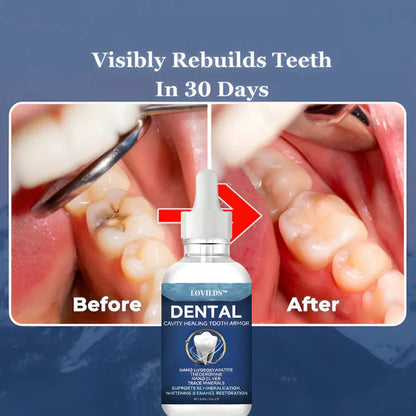 Nano-Hydroxyapatite Deep-Fusion Drops Advanced Enamel