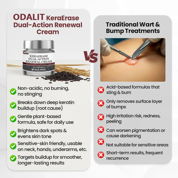 ✅Flash Sale - KeraErase Dual-Action Renewal Cream