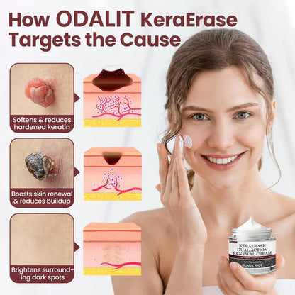 ✅Flash Sale - KeraErase Dual-Action Renewal Cream