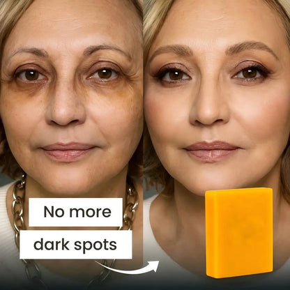 🔥Last Day🔥Buy 1 Get 1⏰ FREETurmeric Kojic Acid Soap for Dark Spots & Glowing Skin Big sale