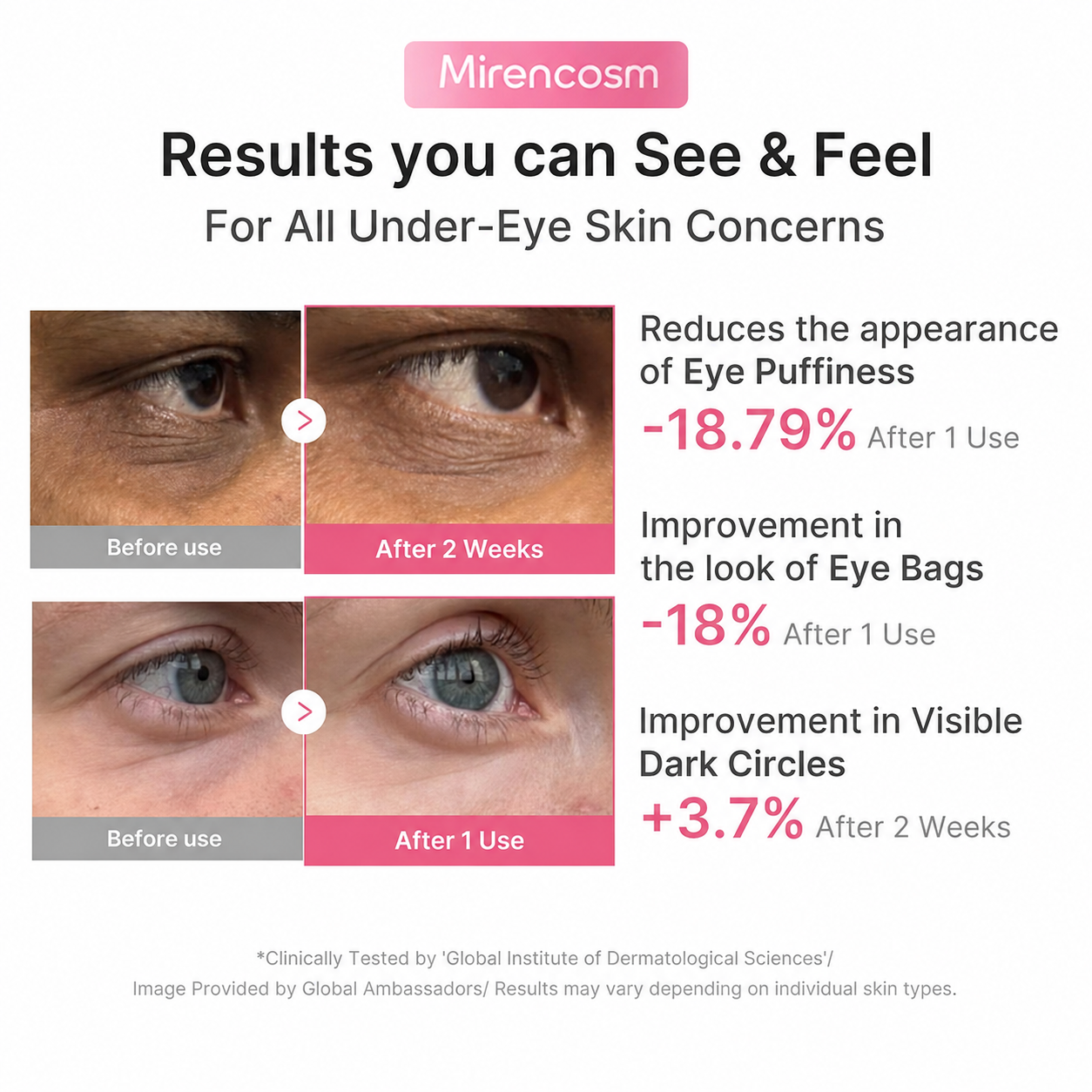 ⏰ Buy 1 Get 1 Free — Refresh Tired Under-Eyes with PDRN Pink Caffeine Collagen Eye Patches Big Sale